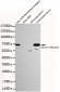 Human Serum Albumin Antibody