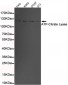 ATP-Citrate Lyase (C-terminus) Antibody