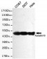 Keratin 18 Antibody