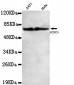 FOXO1 (C-terminus) Antibody