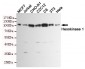 Hexokinase 1 Antibody