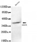 AMACR (C-terminus) Antibody
