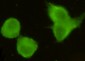 MECT1 / Torc1 Antibody