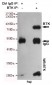 BTK Antibody