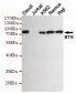 BTK Antibody