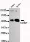 CaMKIV Antibody