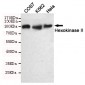 Hexokinase II Antibody