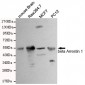 beta Arrestin 1 Antibody