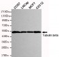 beta Tubulin Antibody