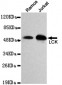 LCK Antibody