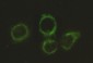 Pyruvate Dehydrogenase E2 Antibody