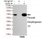 Pyruvate Dehydrogenase E2 Antibody