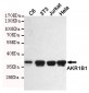 AKR1B1 Antibody