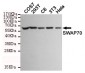 SWAP70 Antibody