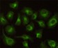 CBR1 Antibody