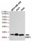 CBR1 Antibody