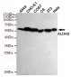 ALDH2 Antibody