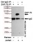 ZAP-70 Antibody