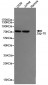 ZAP-70 Antibody