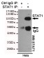 STAT1 Antibody