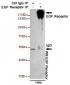 EGF Receptor Antibody