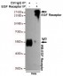 EGF Receptor Antibody