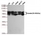 Keratin(50-60kDa) Antibody