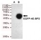 4E-BP2 Antibody