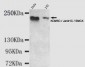 KDM5C / Jarid1C / SMCX Antibody