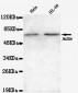 JMJD6(N-terminus) Antibody
