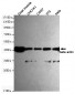 beta Actin Antibody