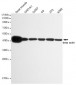 beta Actin Antibody