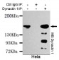 Dynactin 1(N-terminus) Antibody