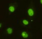 DBC1 Antibody