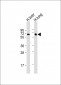 IDUA Antibody (Center)