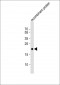 REG3G Antibody  (Center)