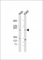 mTOR (FRAP1) Antibody (S2481)