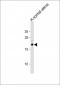 CAV3 Antibody (N-term)