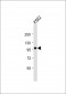 SRPK1 Antibody (N-term)