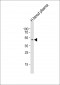 SERPINF1 Antibody (N-term)