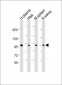 GSN Antibody (N-term)