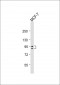 GSN Antibody (N-term)