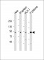 GSN Antibody (C-term)
