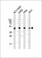 CYK18 Antibody (C-term)