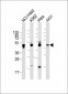 CYK18 Antibody (C-term)