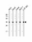 MICA Antibody (Center)