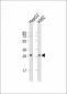 KLRC1 Antibody (C-term)