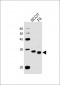 LIN28A Antibody (N-term)