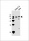 Mouse Cdk8 Antibody (C-term)