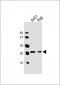 PSMB9 Antibody (C-term)